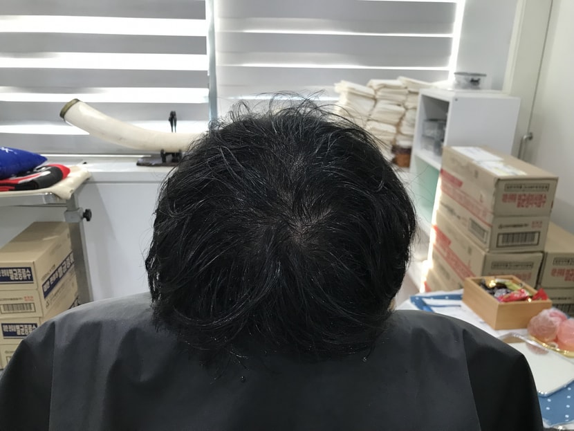 리터치 전 