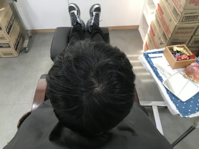 리터치 전 
