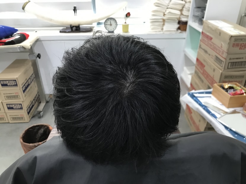 리터치 후