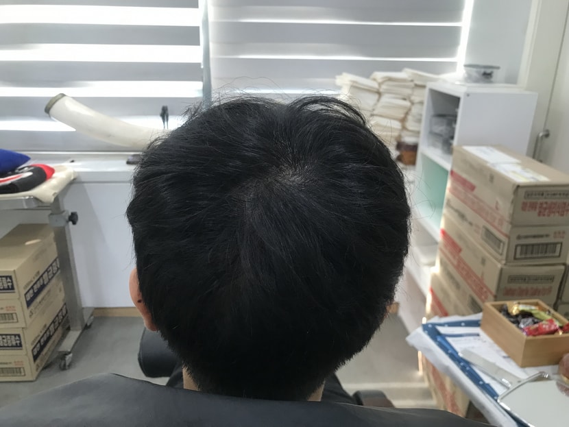리터치 전 