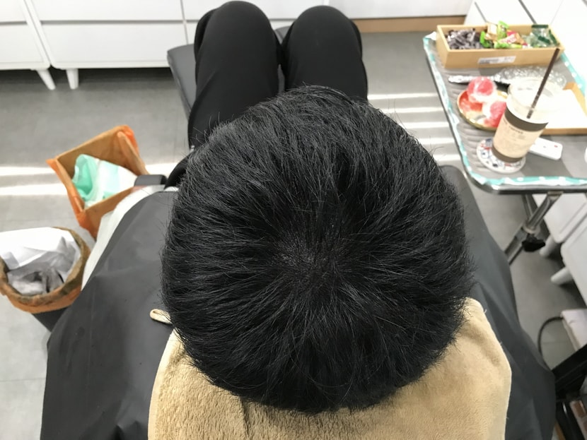2차 리터치 후