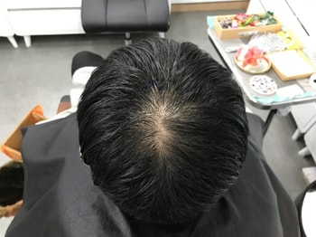 시술전 사진