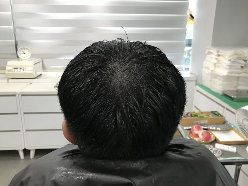 2차 리터치 전
