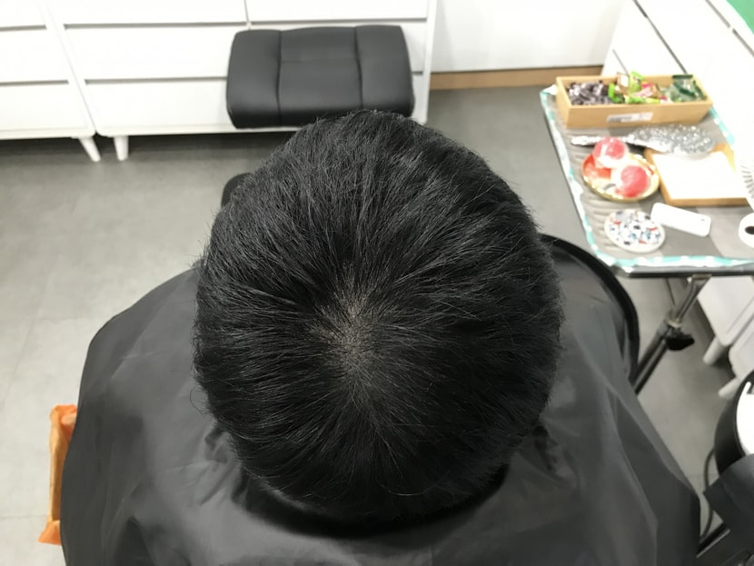 2차 리터치 전