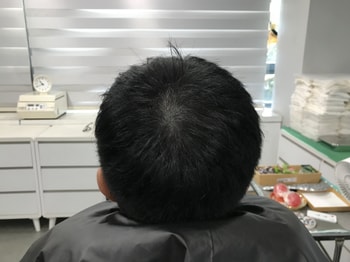 2차 리터치 전