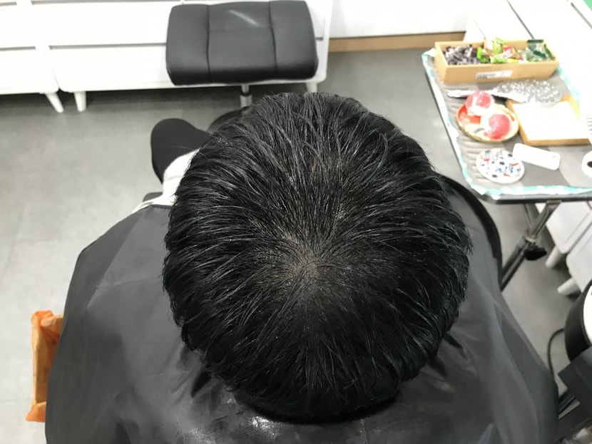 2차 리터치 전