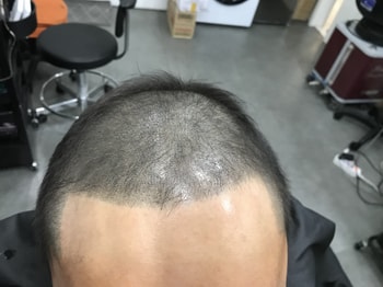 리터치 후 