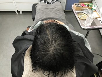 후