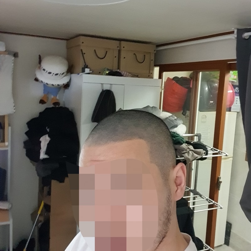 결국 삭발 두피문신 시술 받았습니다. 여친 헤어졌단 글에 엄청 많은 위로글 달렸었는데 여친도 생겼습니당..ㅎ..