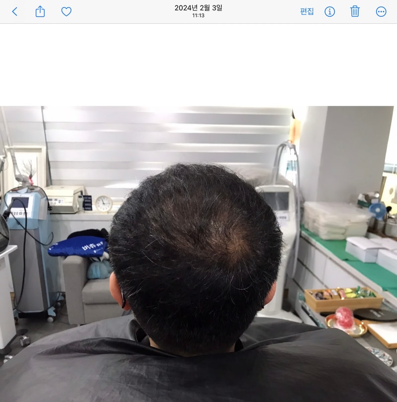 시술전.jpg