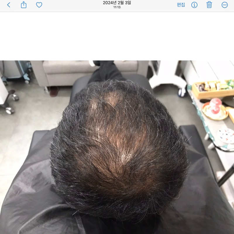 시술전 (2).jpg