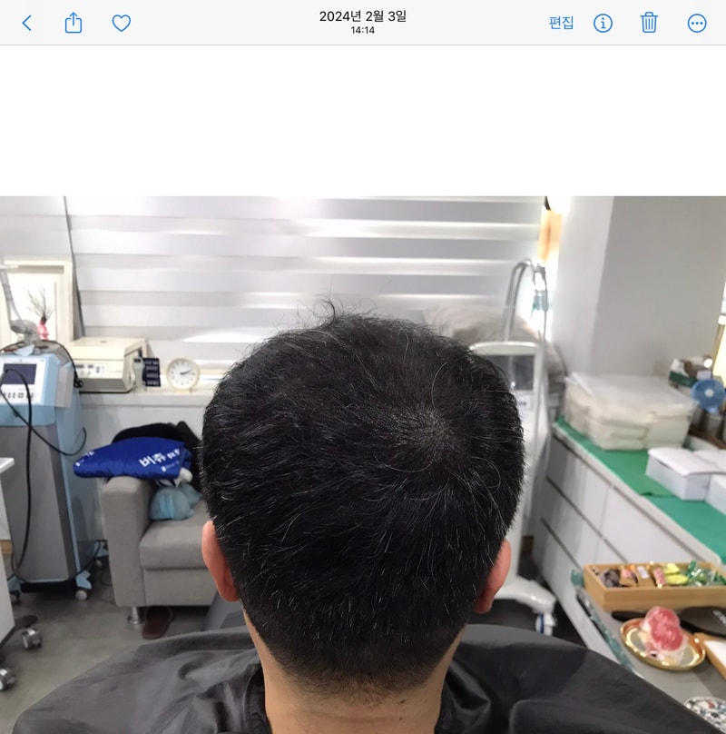 시술후.jpg