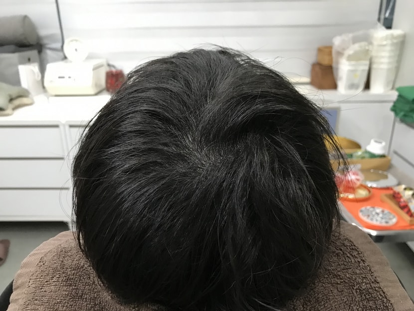 시술후병원사진2