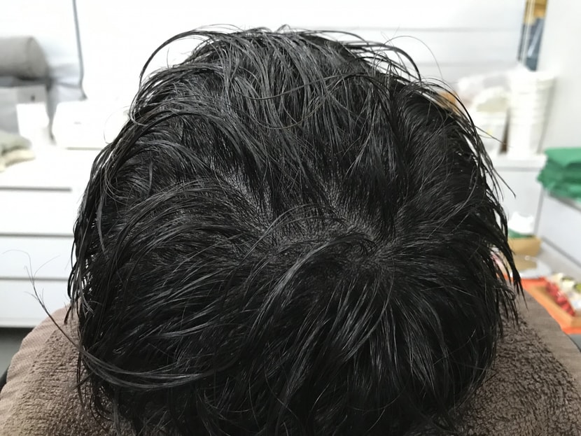 시술후병원사진1