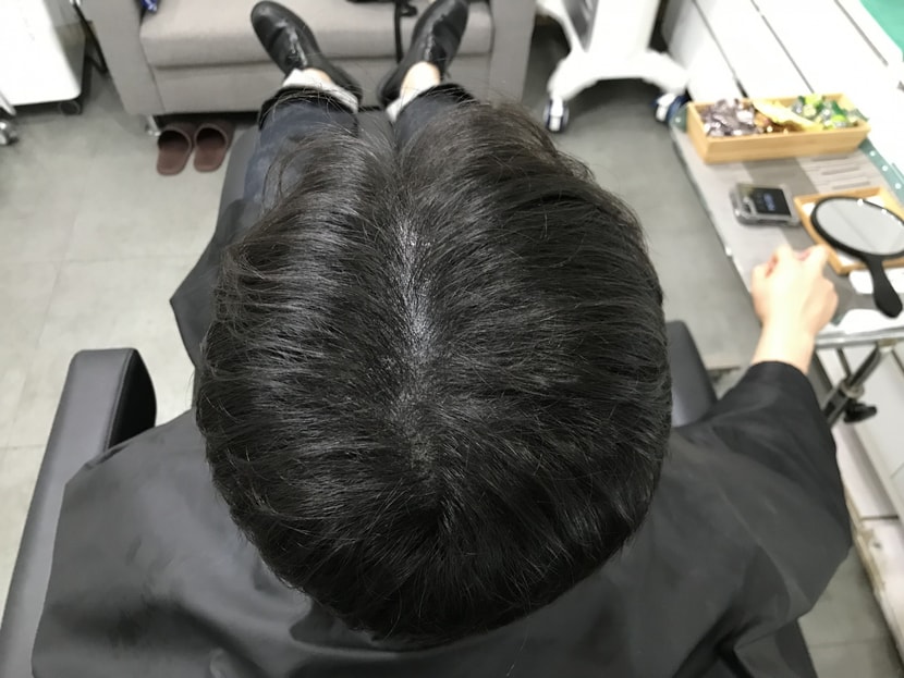 시술 후 병원에서 드라이 후