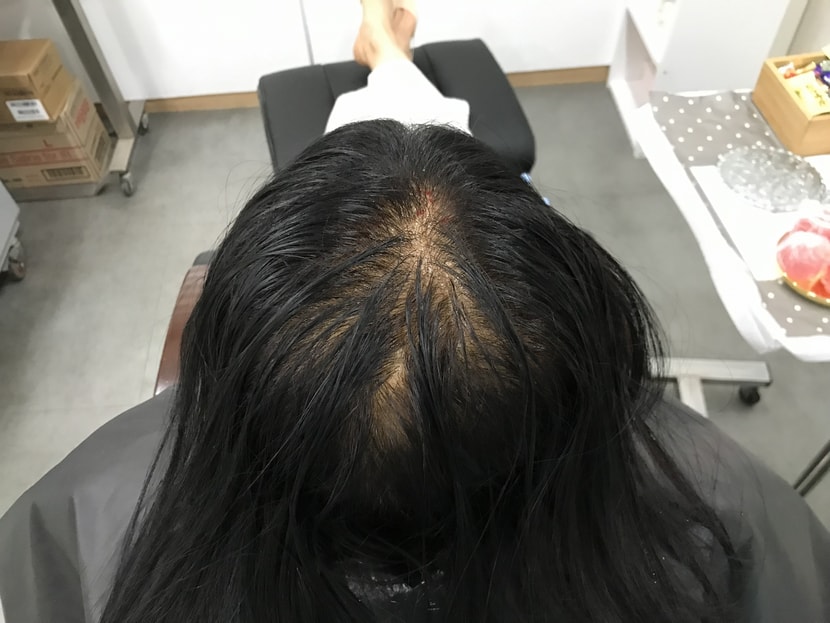 &lt;시슬전&gt;