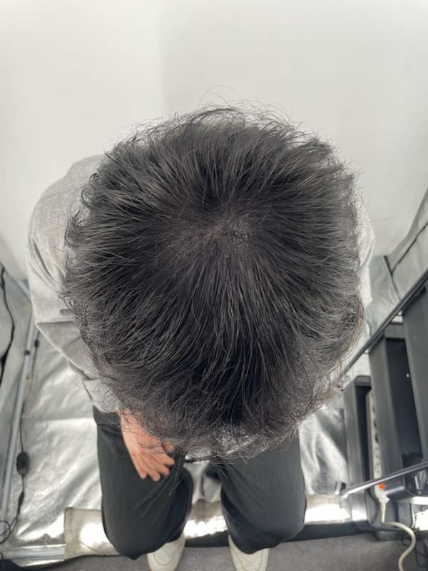 후