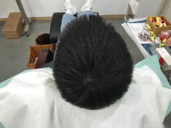 보강후