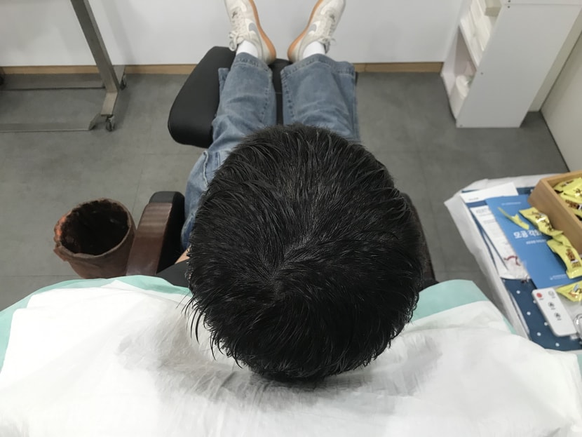 리터치후