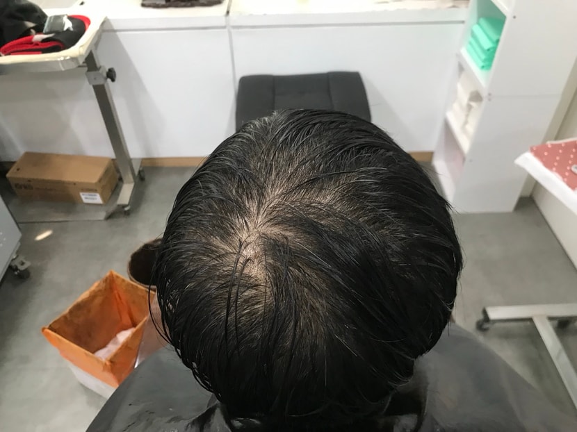 후