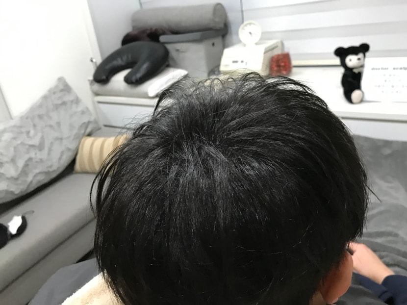 오른쪽