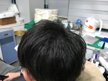 왼쪽