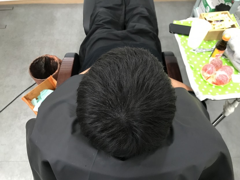 시술 받은 직후