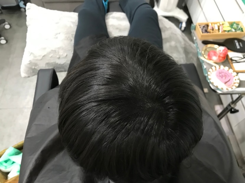 두피문신 후입니다