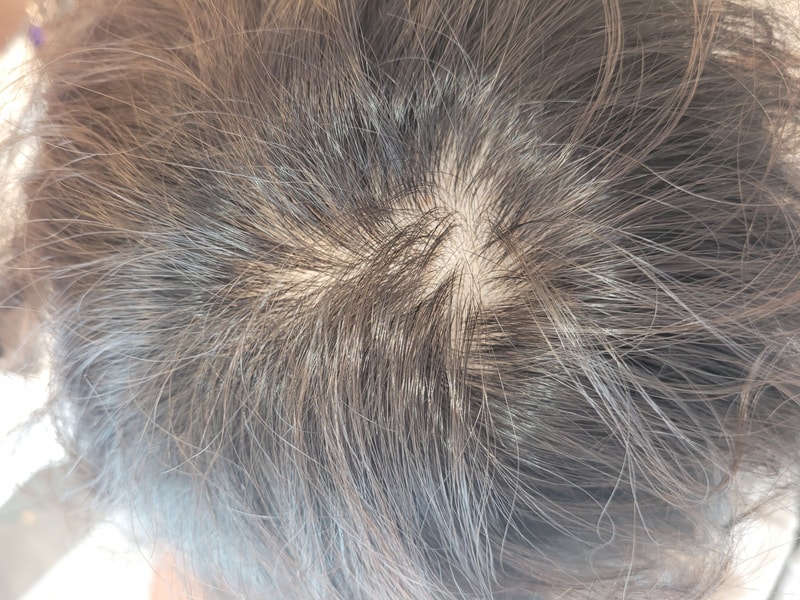 I've completed the second scalp tattoo, should I request a retouch?