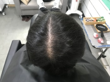 시술전 병원에서 샴푸전