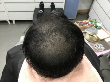 후