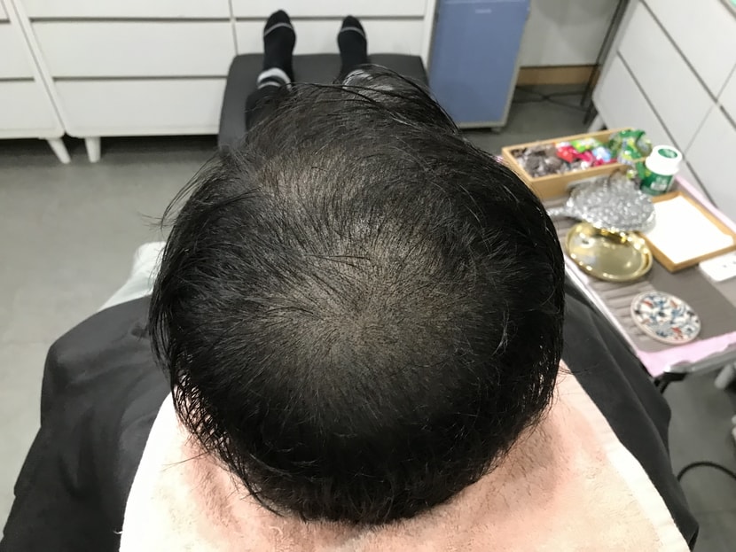 후