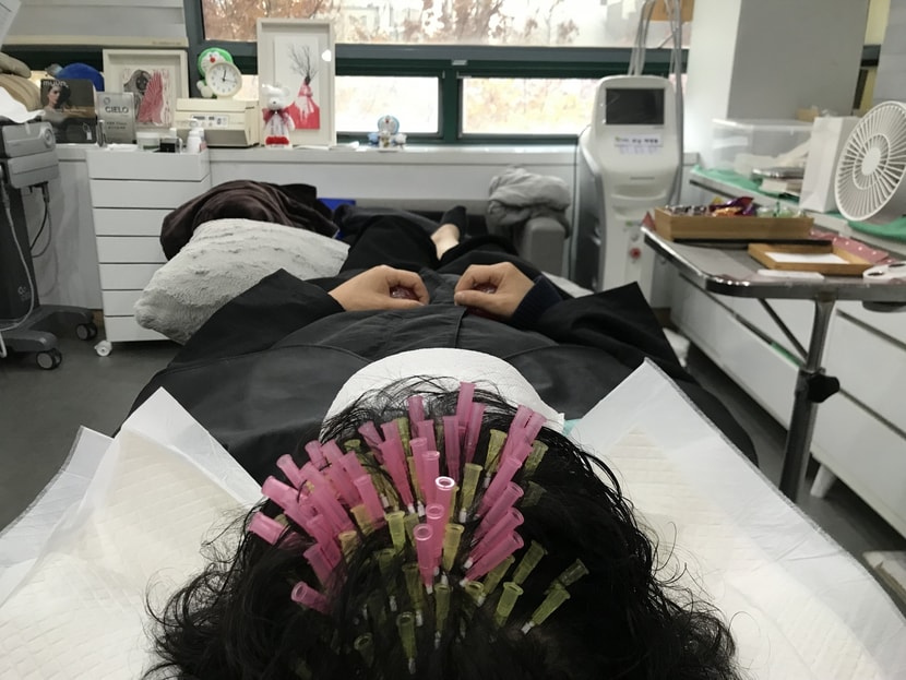 모발볼륨리프팅 치료 사진