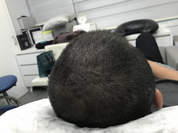병원에서 시술후 2
