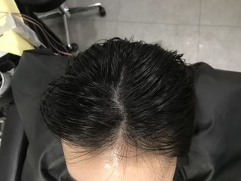 직후라 쫌 빤짝거려요 지금은 괜춘