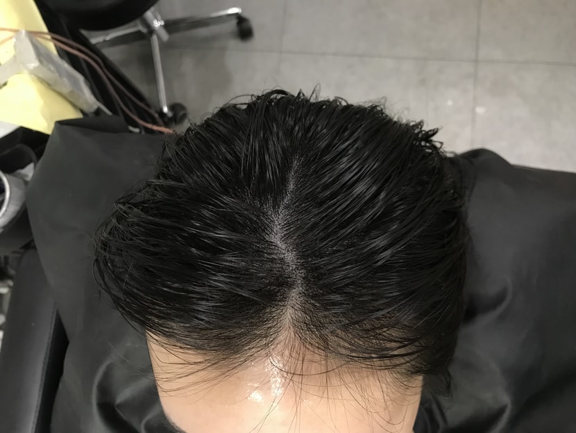 직후라 쫌 빤짝거려요 지금은 괜춘