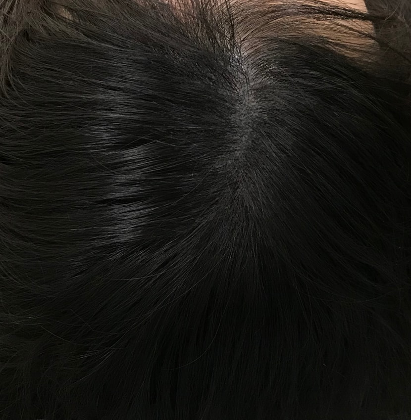 리터치 후