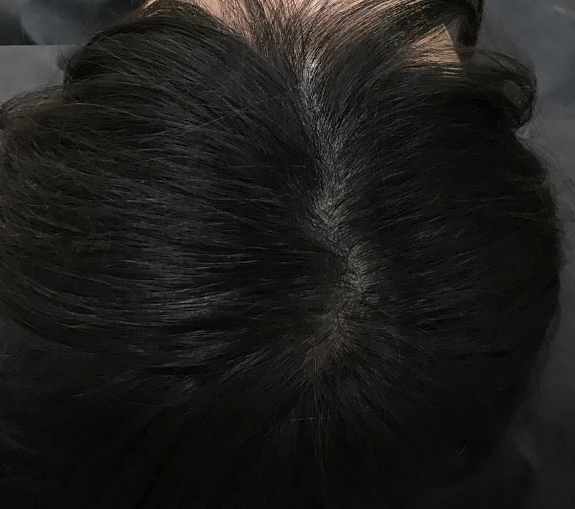 리터치 전