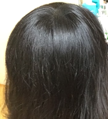 위 두 장은 문신하고 일년 지난 후 입니다. 저는 문신하고 난 뒤로  로게인폼을 사용했는데  머리숱이 좀 채워졌어요.