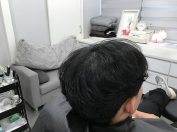 시술후