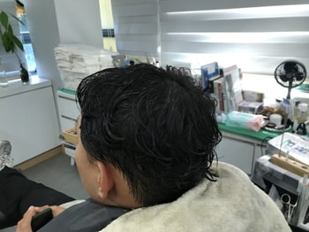 시술후