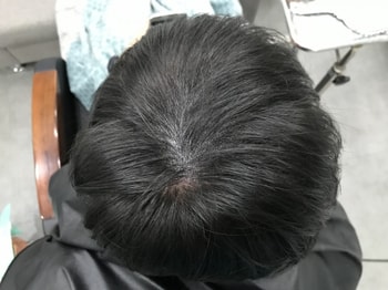 리터치후2
