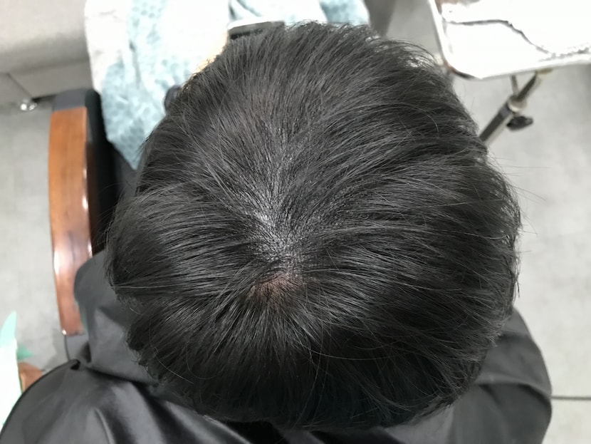 리터치후2