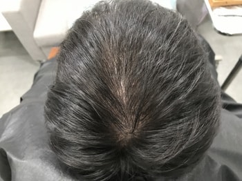 리터치전2