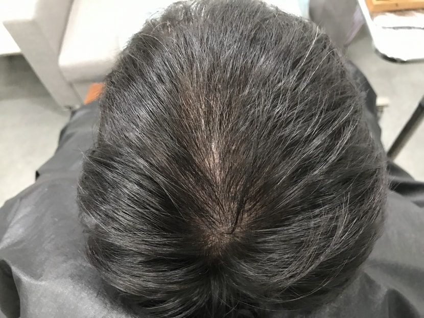 리터치전2