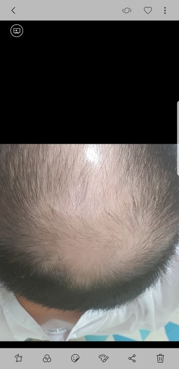 전