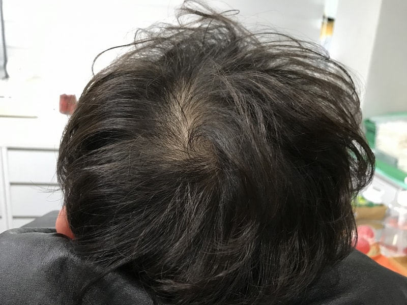 微圆点纹身后期