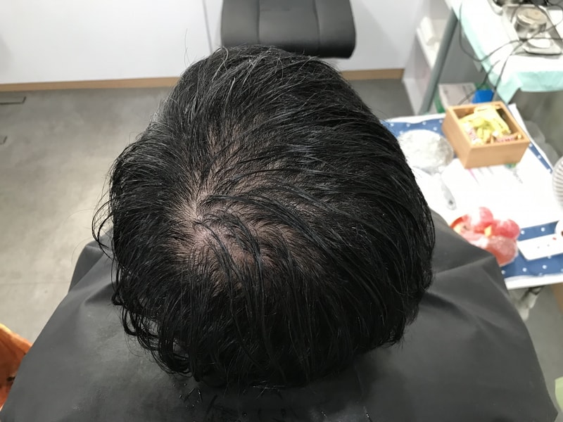 [延世美达人] 渐明渐暗 圆点 后记