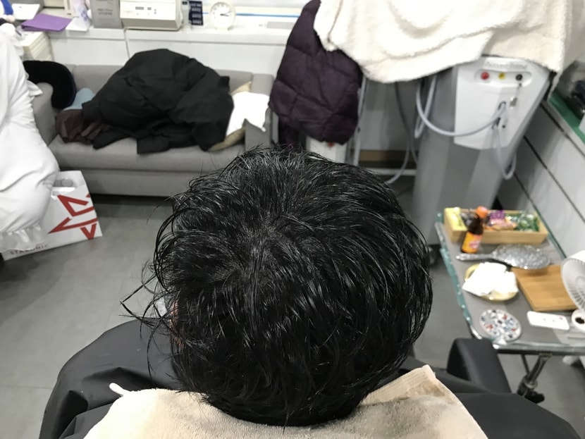 시술 후