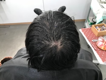 시술전 젖은머리